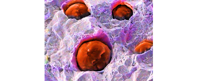 Microstructure de la fonte ductile