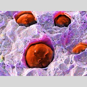 Microstructure de la fonte ductile